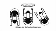 Colocación del PeniMaster<sup>®</sup> para alargar el prepucio